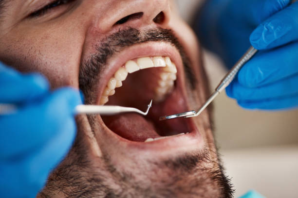 Best Urgent Care for Lost Fillings or Crowns in Valdosta, GA